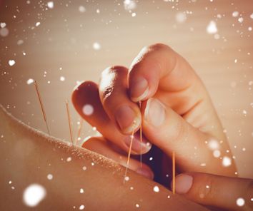 Snow against young woman getting acupuncture treatment